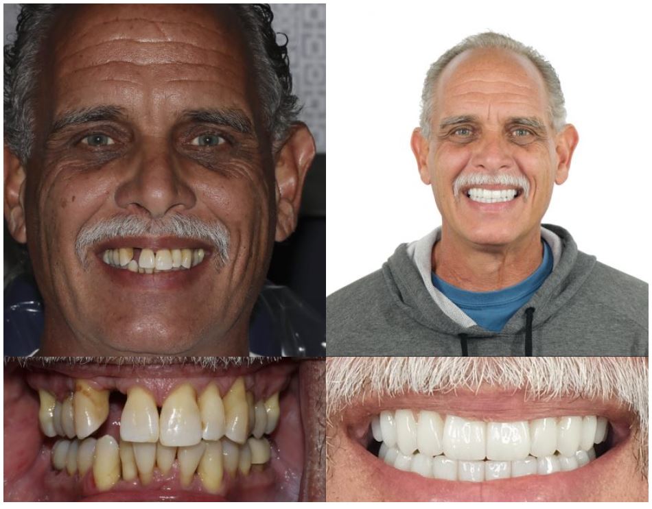 Images of man with new smile